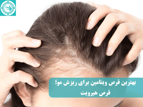 درمان ریزش مو با قرص هیرویت